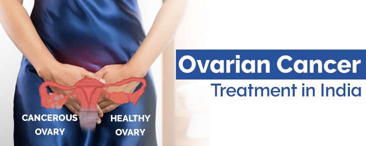 Ovarian Cancer Treatment in India